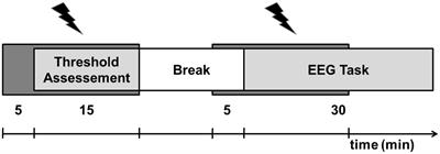 Transcranial Random Noise Stimulation (tRNS) Shapes the Processing of Rapidly Changing <mark class="highlighted">Auditory Information</mark>